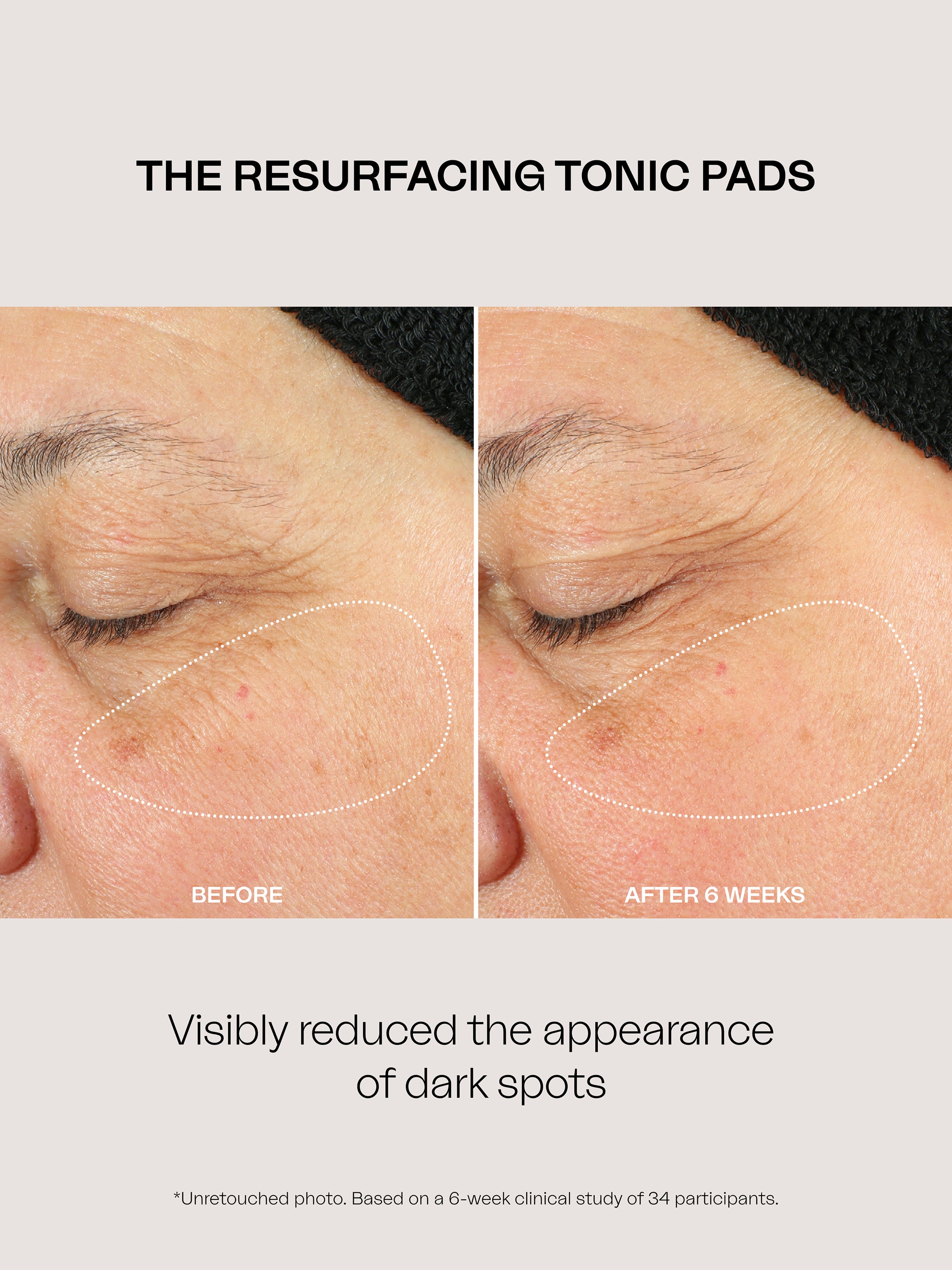Resurfacing Tonic Pads – VIOLET GREY