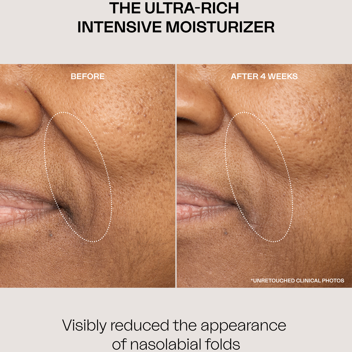 The Ultra-Rich Intensive Moisturizer – VIOLET GREY