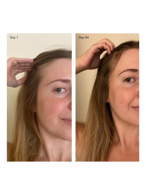 holi (growth) 84 advanced leave-in growth scalp treatment