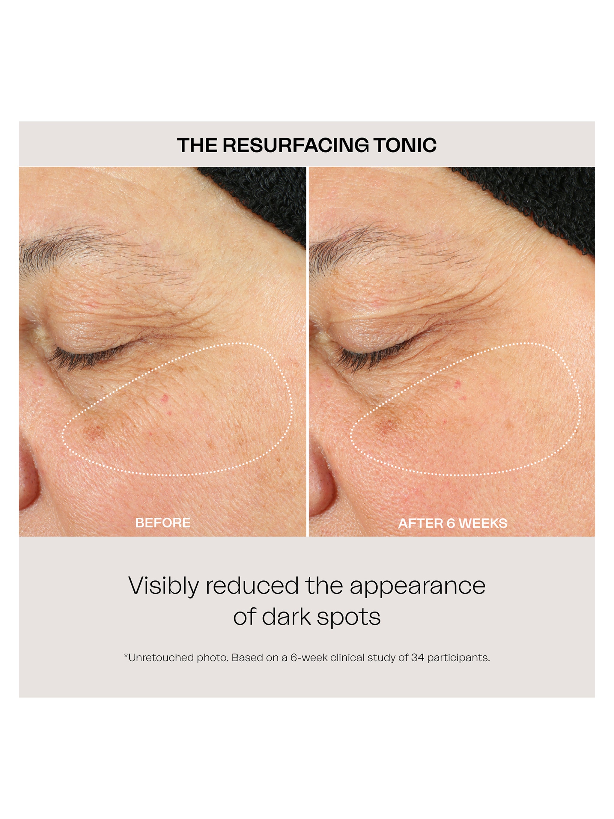 Resurfacing Tonic – VIOLET GREY