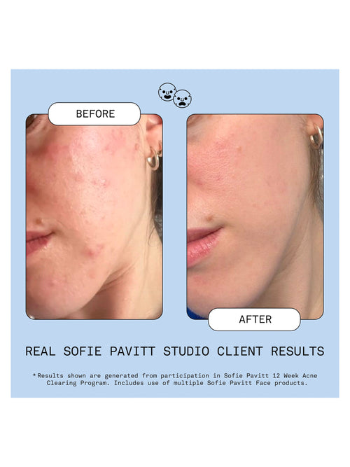 Fridge to Face Blemish Defense Mist