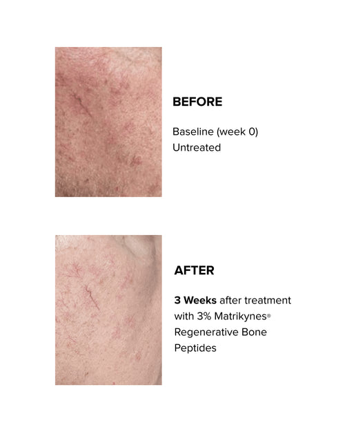 Elasticity Reinforcing Lipid-Cream