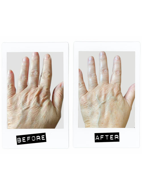 Activating Hand Serum