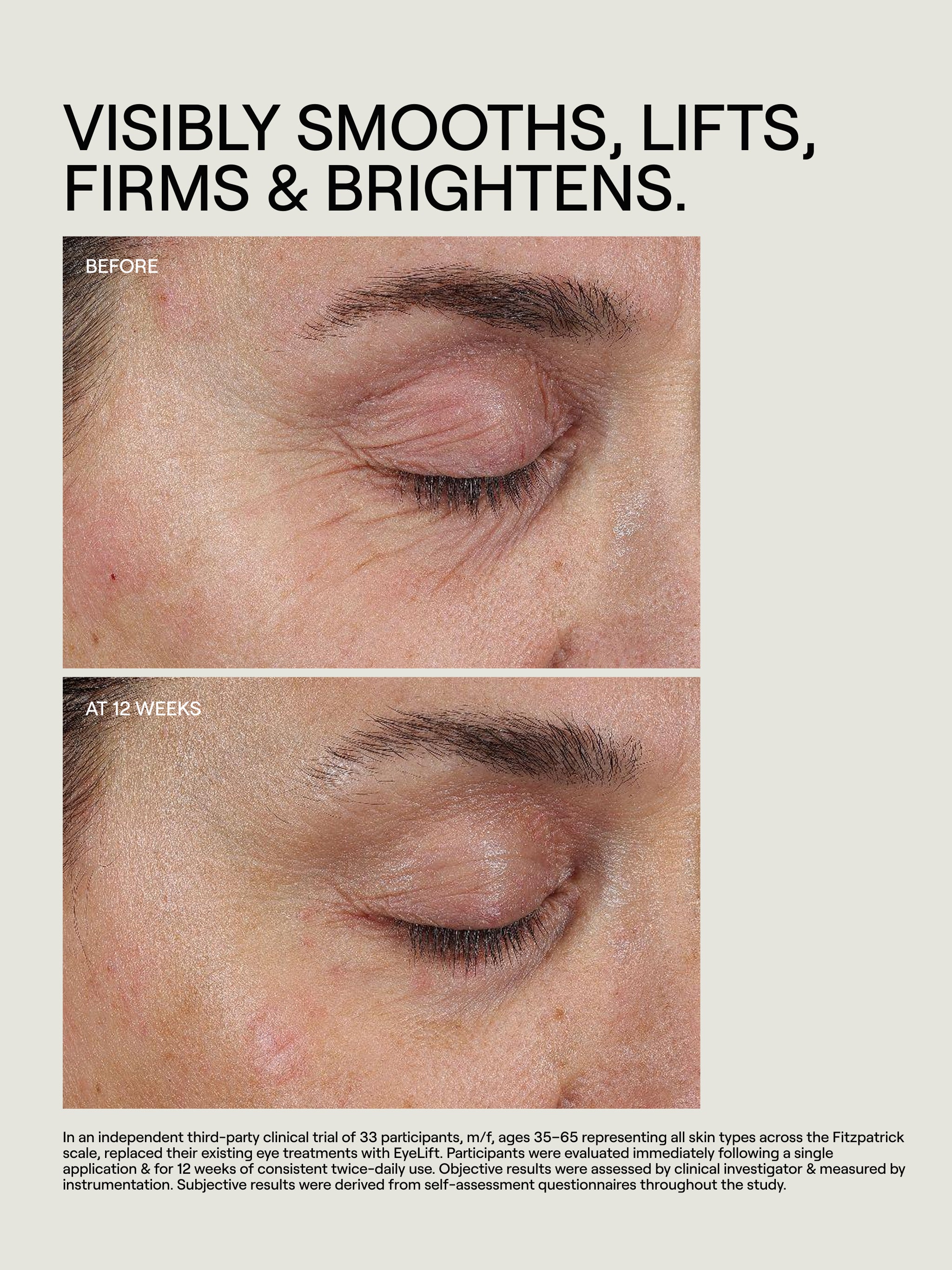 MALOWI ピスタチオ　アンドメディカル EyeLift Bioremodeling Peptide Multiplex – VIOLET GREY