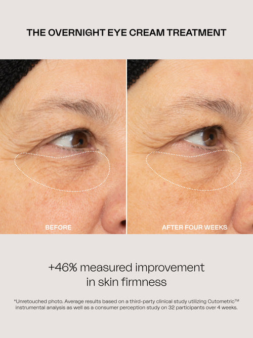 The Overnight Eye Cream Treatment
