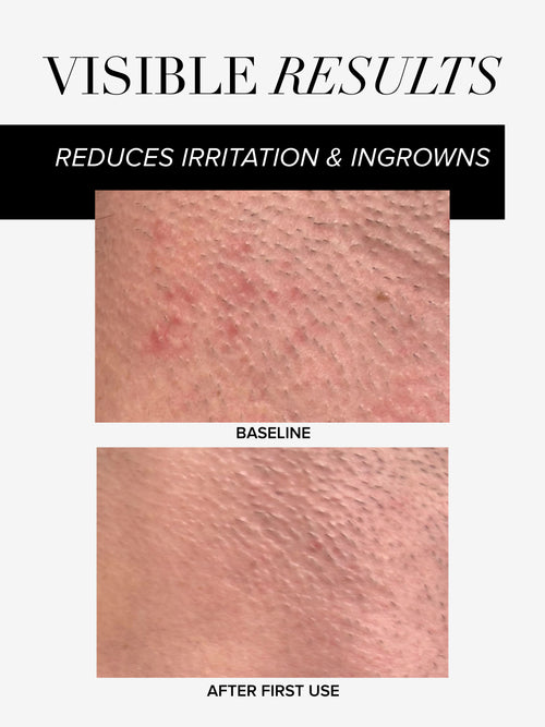 The Nood Serum