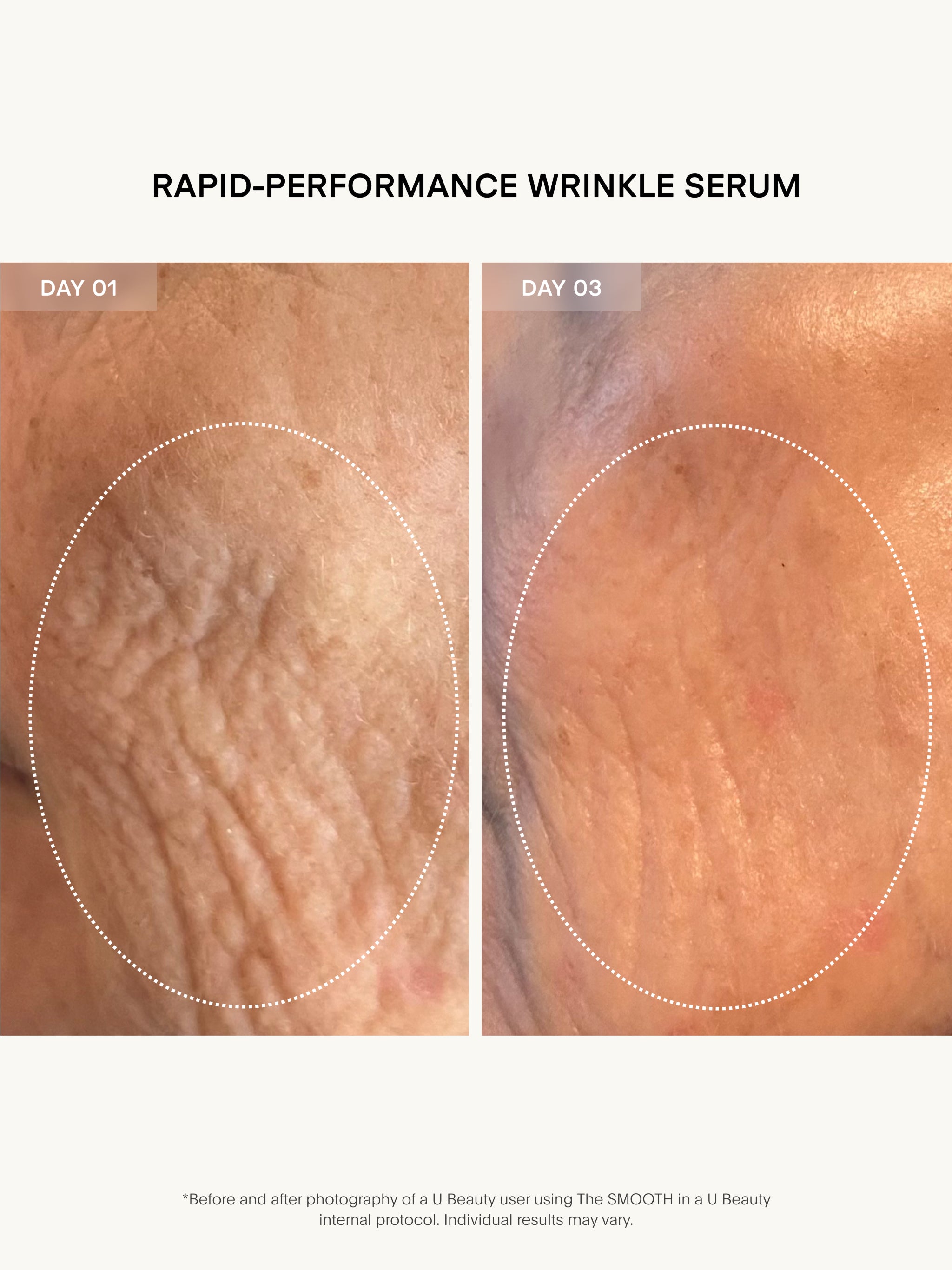 The SMOOTH Dynamic Wrinkle Defense Serum – VIOLET GREY
