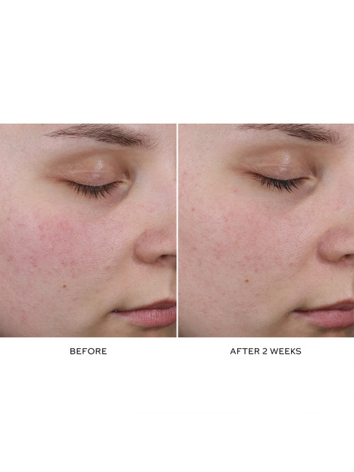 Pore Refining Complex
