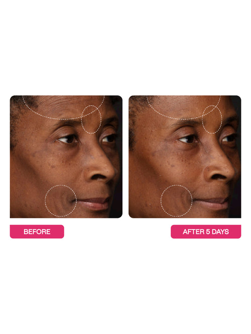 Wrinkle Relaxing Moisturizer