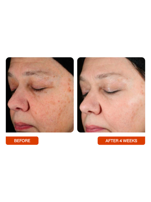 Universal C Skin Refiner