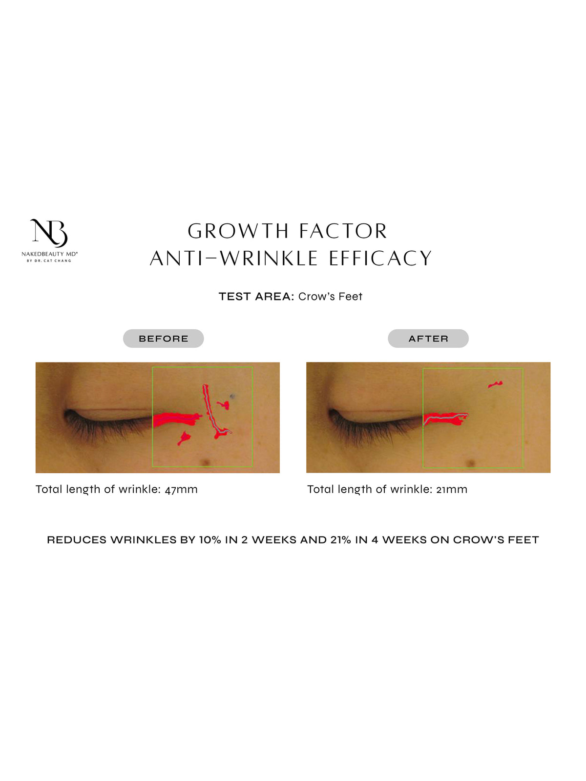 Advanced Eye Factor Biopeptide Growth Factor Eye Therapy – VIOLET GREY