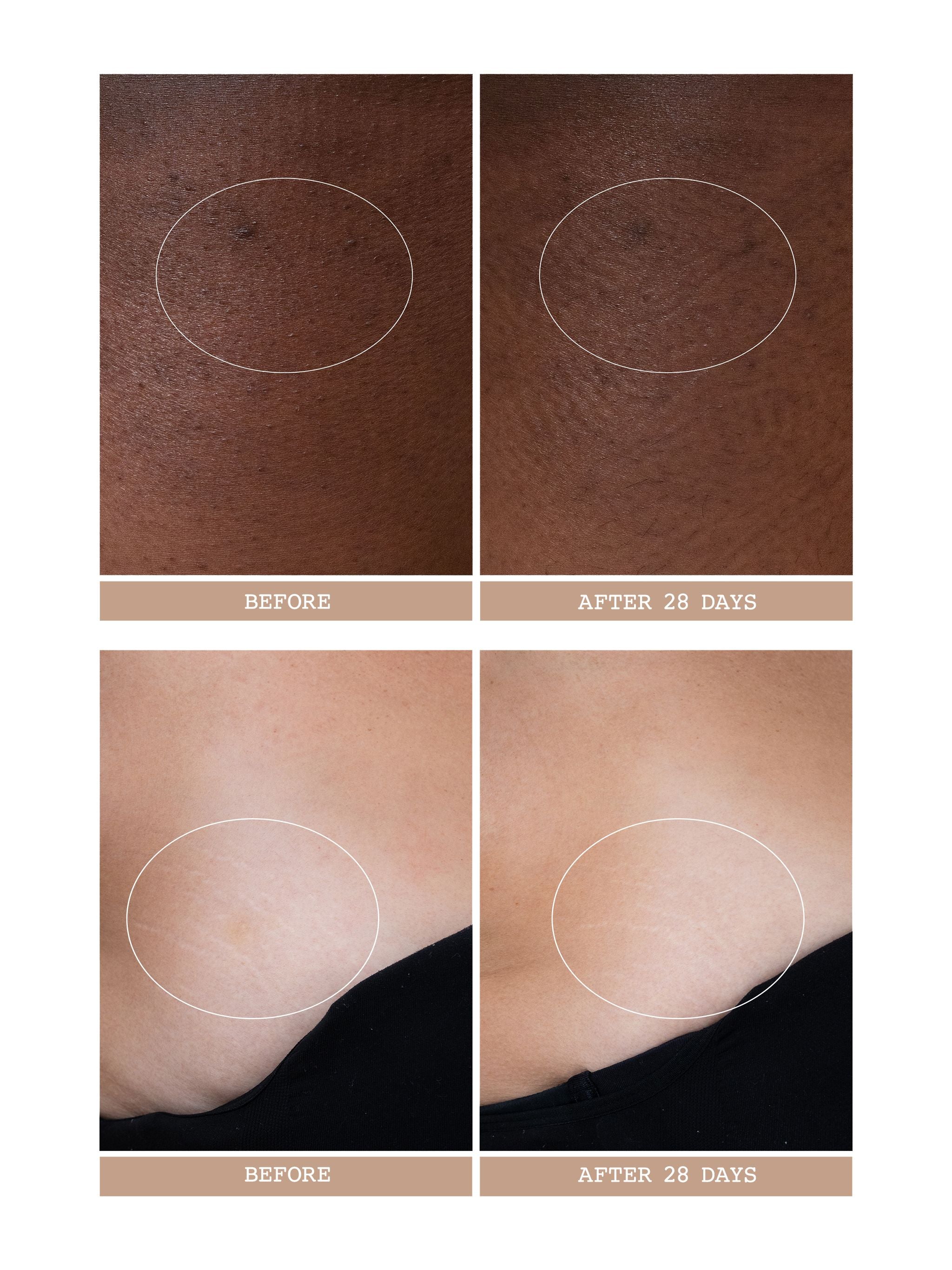 Body Reform Treatment Serum – VIOLET GREY