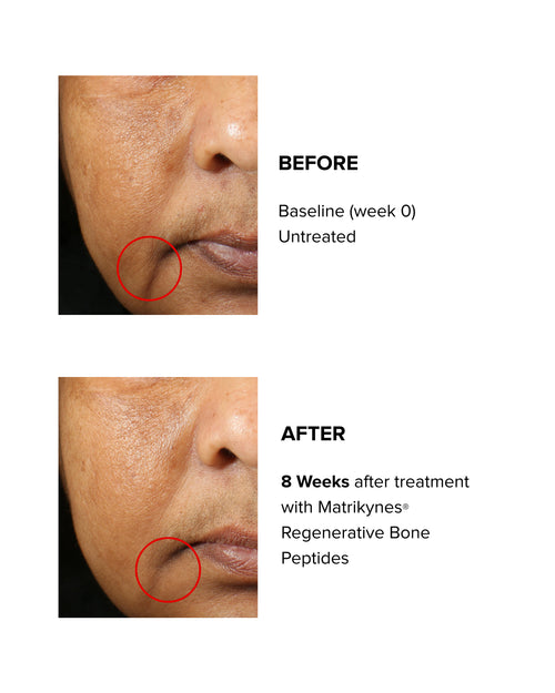 Barrier Repairing Oil-Serum